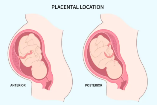 Anterior vs. Posterior Placenta: Facts for a Healthy Pregnancy